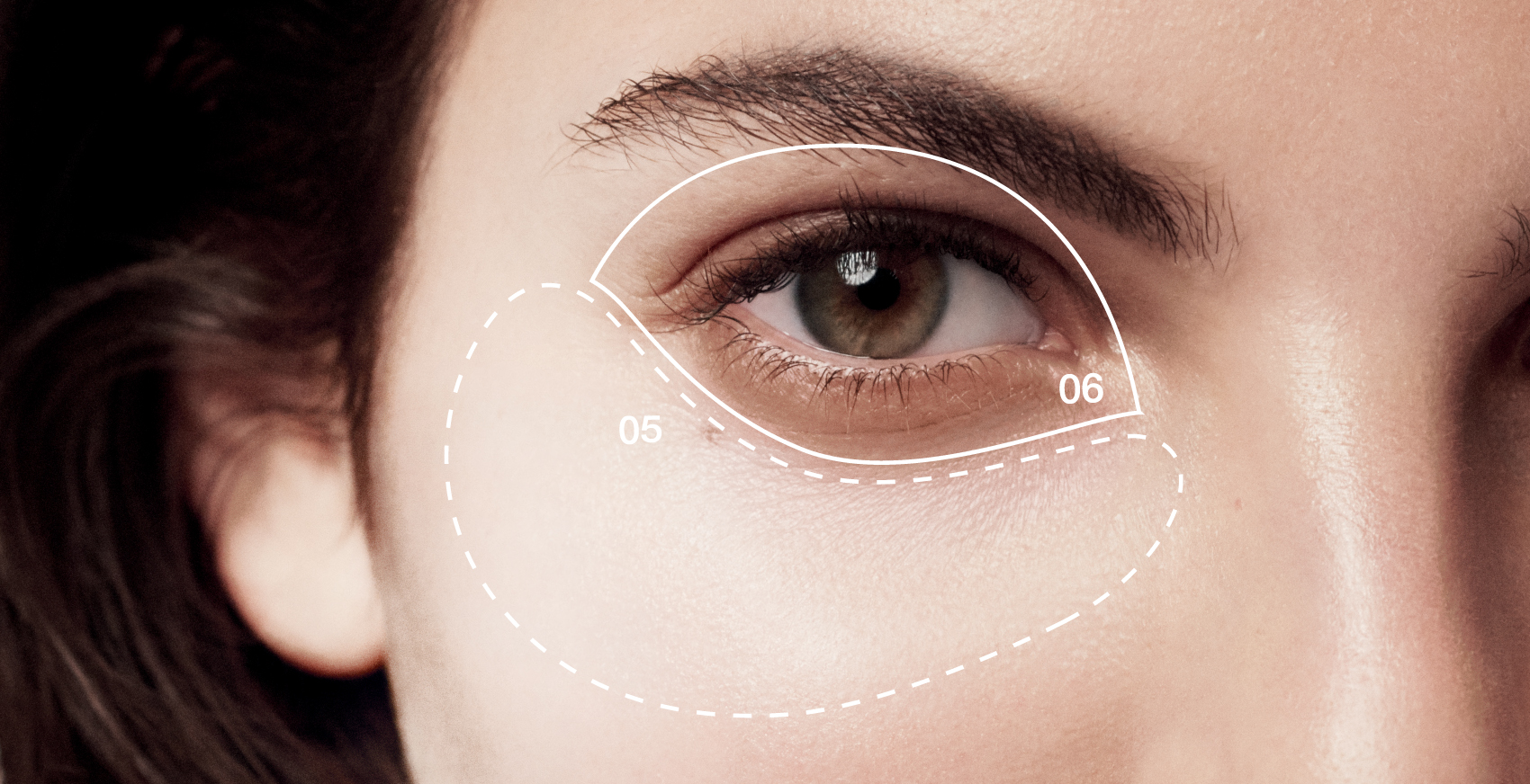 What Causes Dark Puffy Circles Under Eyes