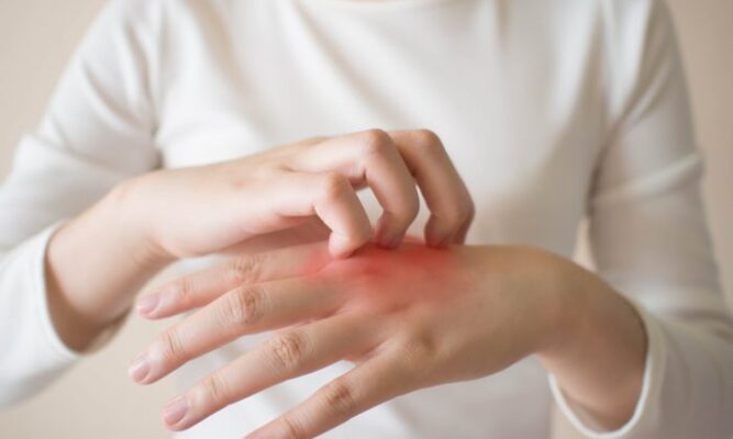 A Bruise To Itch, Causes & Treatment - Women Magazine PK