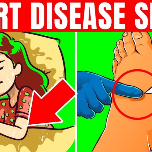 15 Early Warning Signs Of Heart Disease You Should Lookout For